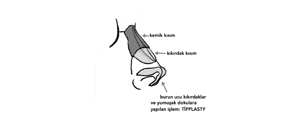 burun-ucu-estetigi-tipplasty