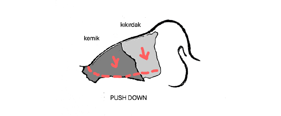 push-down-estetik
